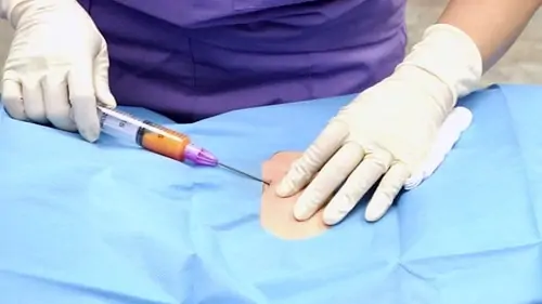 Fat is harvested from the belly, and stem cells from it are widely used in clinical medicine.