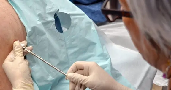 Bioidentical Hormone Replacement Therapy