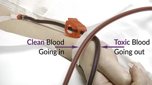 Clean Ozonated Blood