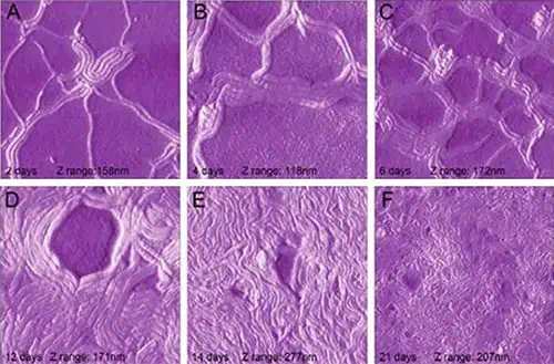 Treatment Of Lyme Disease