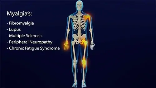 Borrelia often lodge within the joints causing a variety of joint myalgia’s as well as other symptoms.