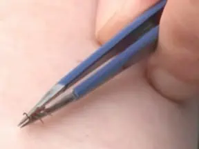 If you find a tick on your body remove it ASAP!