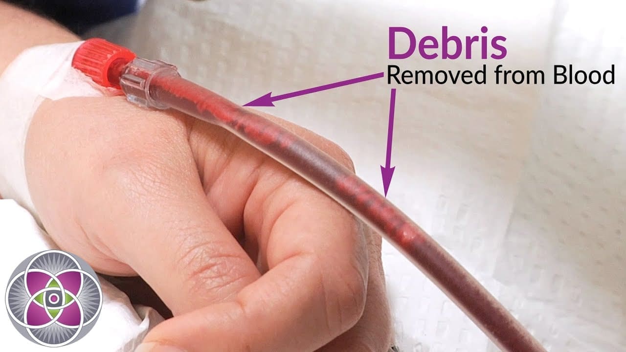 Debris Being Filtered Out of The Blood