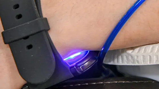Patient receiving photodynamic therapy with IV Methylene Blue and laser light watch