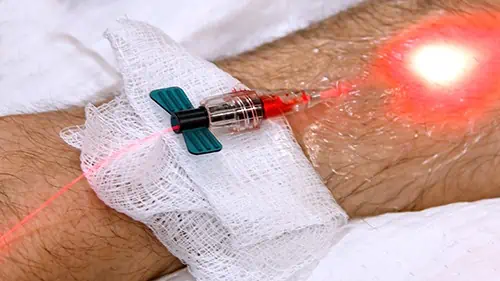 IV Red Light Therapy Boosts Cell Energy and Improves Circulation