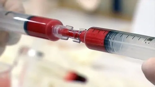 stem cell fibrin matrix mixing