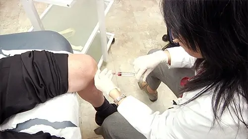 stem cell injecting cells