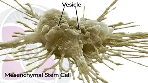 Image of a Wharton’s jelly stem cell from placental tissue