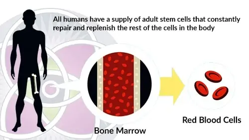 Adult stem cells can be taken from the patient’s femur bone
