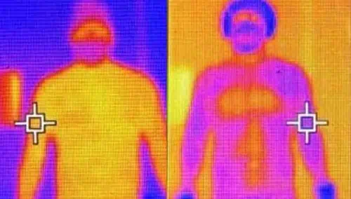 thermal camera cryotherapy
