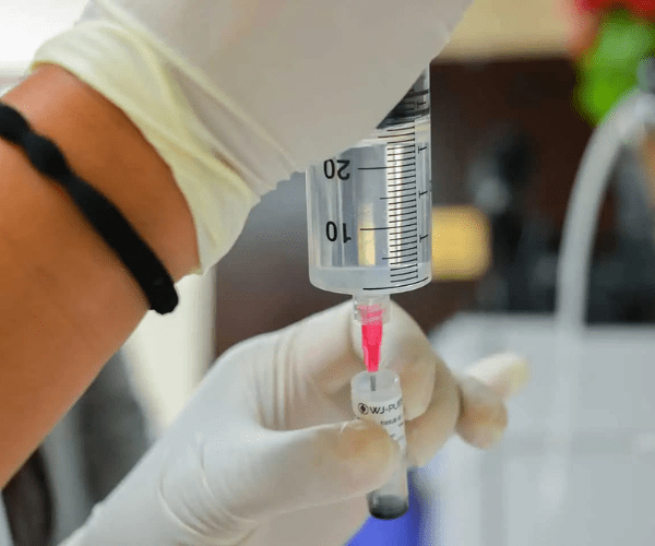 At AMA RegenMed, Dr. Pien's clinical team meticulously prepares potent stem cell concentrations, ensuring the highest quality for patient treatment