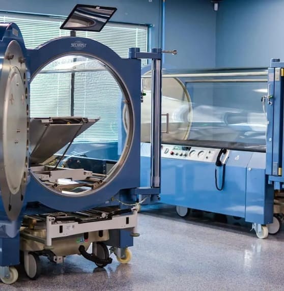 Two modern blue monoplace hyperbaric oxygen chambers in a clinical room, with one chamber open showing the patient bed.