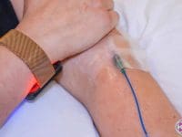 a-long-covid-patient-receiving-intravenous-methylene-blue-with-photodynamic-therapy-ama-regenerative-medicine