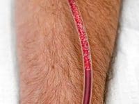 blood-cleansing-eboo