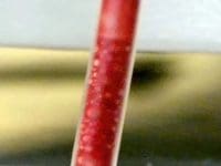 Extreme close-up showing particles in the blood tubing of a vaccine-injured patient during EBOO therapy.