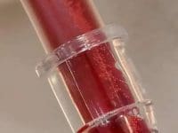 Close-up of blood and potential debris flowing through the IV tubing connector during EBOO ozone treatment.