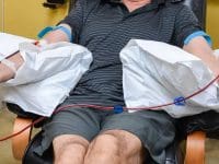 Patient receiving EBOO/Apheresis treatment with blood extraction and reinfusion at AMA Regenerative Medicine.