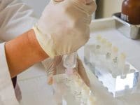 Gloved medical staff preparing an exact dose of Mesenchymal Stem Cells (MSCs) from labeled vials for patient treatment.