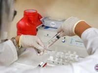 Medical professional filling a syringe with stem cell product in a sterile environment for regenerative therapy.