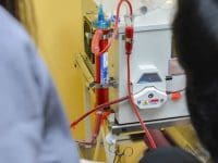 eboo-2-nurses-performing-extracorporeal-blood-oxygenation-and-ozonations-with-filtration-procedure-on-patient-ama-regenerative-medicine