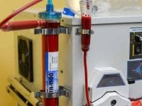 Detailed view of the EBOO device's blood filter (dialyzer) and ozonation system components during the cleaning process.