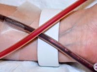 eboo-dark-toxic-blood-contrasted-by-bright-clean-blood