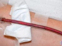 eboo-iv-line-filled-with-debris