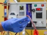 A gloved nurse checking the blood tubing and IV line to ensure safe and effective Extracorporeal Ozone Therapy treatment.