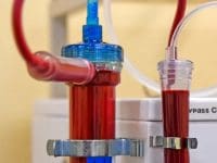 eboo-ozone-therapy-for-long-covid