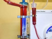 EBOO (Extracorporeal Blood Oxygenation and Ozonation) machine in use, filtering blood as a specialized Long COVID treatment.