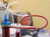 eboo-treatment-with-patient-in-background-ama-regen-med