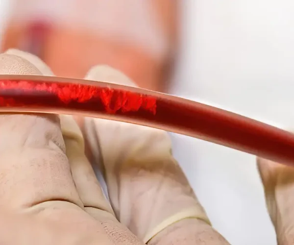 header-eboo-therapy2