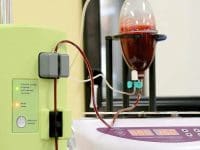 Blood being treated and swirled in the Hemodynamic Apparatus during Hyperbaric Ozone Therapy treatment.