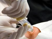 Patient receives an intra-articular injection of ozone gas to promote natural healing and joint regeneration.