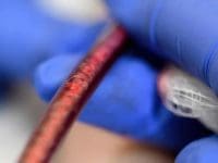 long-haul-covid-eboo-ozone-therapy-ama