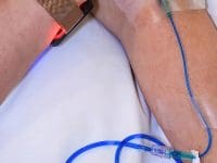 Patient receiving Methylene Blue IV and light therapy to stimulate mitochondria and heal Long COVID fatigue.