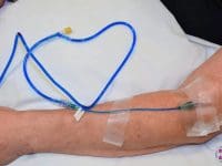 methylene-blue-iv-for-long-covid-patient-with-extreme-fatigue-ama-regenerative-medicine