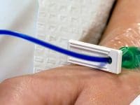 Close-up of Methylene Blue IV treatment being administered for Long COVID neurological symptom relief.
