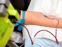 Close-up of a patient's arm during Multi-Pass Ozone Therapy, showing the specialized IV line and tubing.