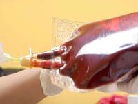 nurse-infusing-blood-with-ozone