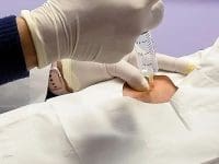 Medical professional performing an ozone injection into a patient's affected joint area.