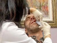 Close-up view of a doctor administering a therapeutic ozone injection into the patient's nasal sinus area.