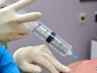 Doctor using a large syringe to administer regenerative ozone injection to a patient's shoulder.