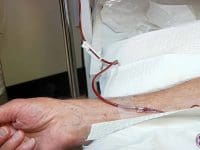 Ron's testimonial photo showing the intravenous line during his 10-Pass ozone therapy treatment.