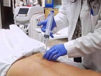 Dr. Alice Pien performing a large volume ozone injection into the lower back region of a patient lying on a medical bed.