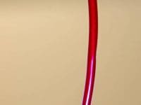 ozone-therapy-iv-line