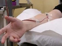 Patient's hand and arm with the IV access set up for the ozone therapy procedure at AMA Regenerative Medicine.