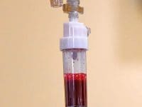 single-dose-ozone-therapy-iv-bag