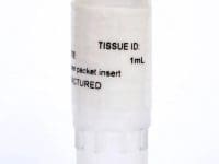 single-vial-of-mesenchymal-stem-cells