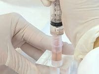 Close-up of a syringe drawing concentrated stem cells or PRP fluid for a regenerative medicine treatment at AMA Regen Med.